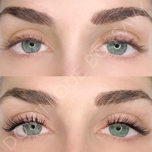 Eyes