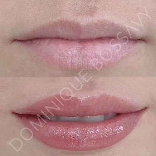Lips