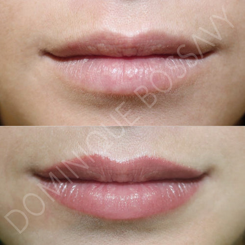 Lips