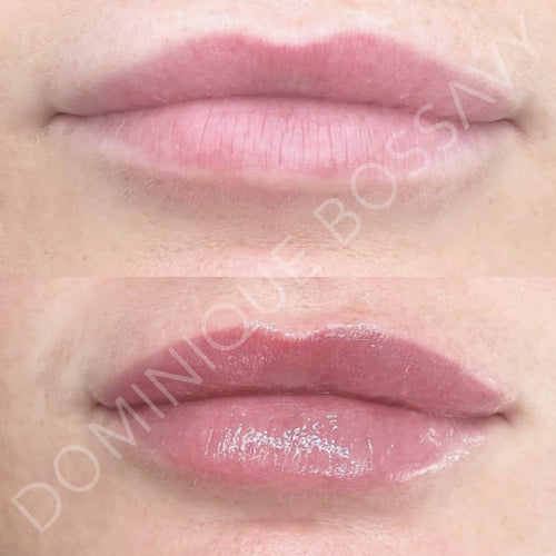 LIPS