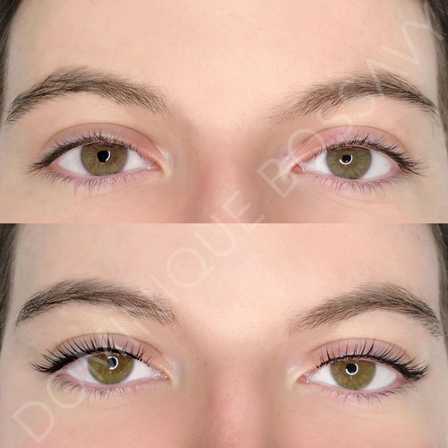 Eyes