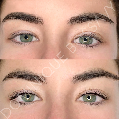 Eyes