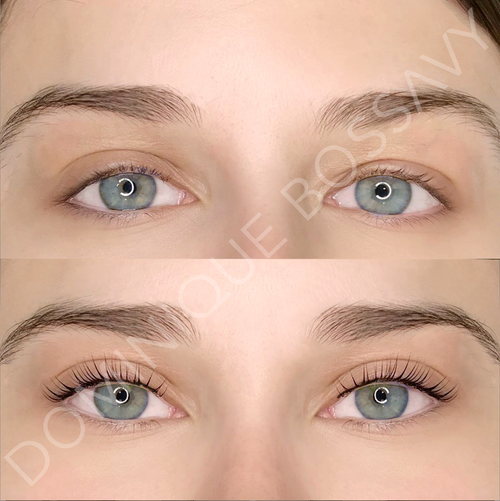 Eyes