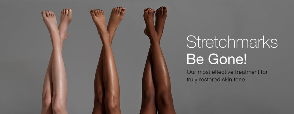 Dominique Bossavy – Stretchmarks Be Gone! Our most effective treatment for truly restored skin tone.