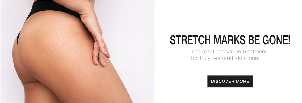 Stretch Marks Be Gone! The most innovative treatment for truly restored skin tone. Click to Discover More about Dominique Bossavy's Stretch Marks Camouflage service.